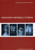 estenosis vertebral lumbar