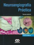 neuroangiografia practica (3ª ed.)