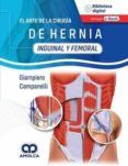 el arte de la cirugía de hernia. inguinal y femoral