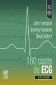 160 casos de ECG