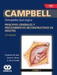 campbell ortopedia quirurgica (tomo 1): principios generales y procedi