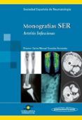 monografias ser artritis infecciosa