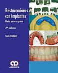 restauraciones con implantes guia paso a paso