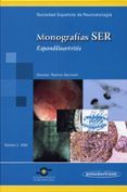 monografia ser: nº 2 (2004): espondiloartritis