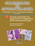 puncion aspiracion con aguja fina en el diagnostico de los tumores de hueso