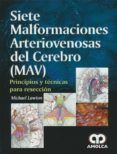 siete malformaciones arteriovenosas del cerebro mav