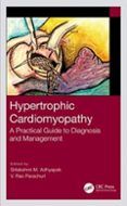 hypertrophic cardiomyopathy