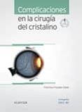 complicaciones en la cirugia del cristalino + acceso web