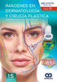 imagenes en dermatologia y cirugia plastica