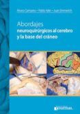abordajes neuroquirurgicos al cerebro y a la base del craneo
