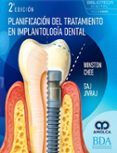 planificacion del tratamiento en implantologia dental