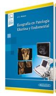 ecografia en patologia uterina y endometrial incluye version digital