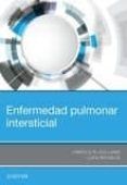 enfermedad pulmonar intersticial