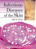 infectious diseases of the skin