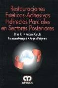 restauraciones esteticas-adhesivas indirectas parciales en sector es p