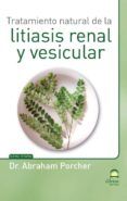 tratamiento natural de la litiasis renal y vesicular