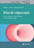 atlas de colposcopia de la imagen colposcopica a la histopatologia
