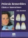 protesis removibles clasica e innovaciones