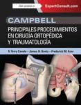 campbell principales procedimientos en cirugia ortopedica y traumatol