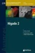 higado 2 avances en diagnostico por imagenes 16