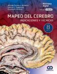 mapeo del cerebro indicaciones y tecnicas